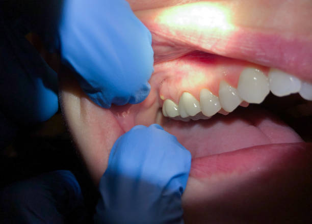 Best Emergency Gum Pain Relief  in Royersford, PA