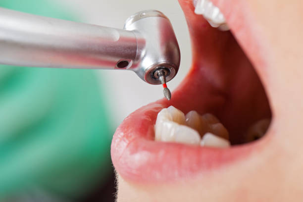 Best Urgent Tooth Repair  in Royersford, PA